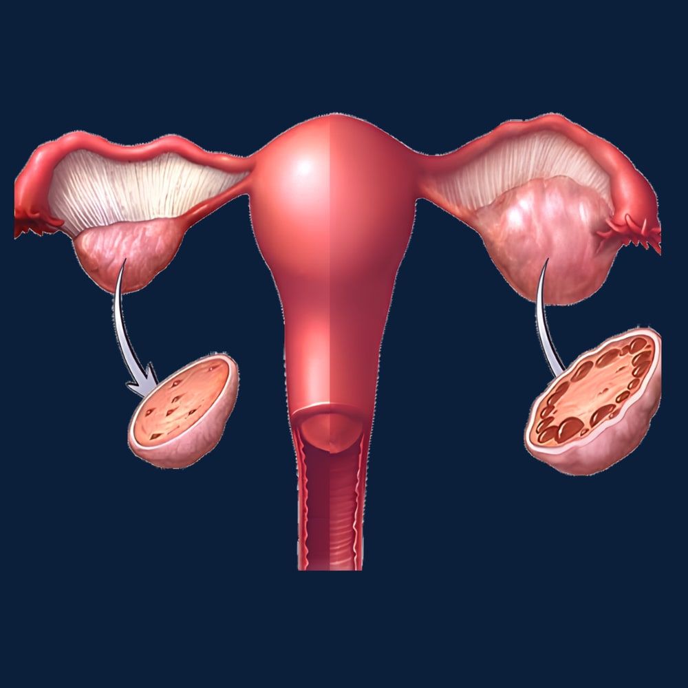 A diagram of the womb and both ovaries, with a cutaway showing the follicles inside each ovary.